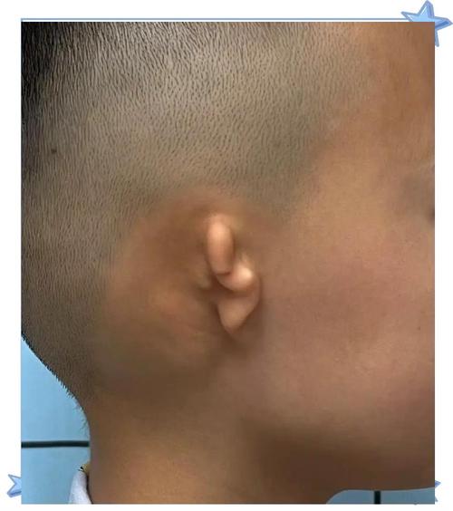 单侧耳朵像打鼓一样_耳朵咚咚响?别大意,可能是身体在报警! 单侧耳朵像打鼓一样_耳朵咚咚响?别大意,可能是身体在报警!